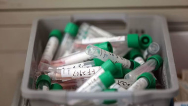 China autoriza que vacuna contra coronavirus sea sometida a pruebas en humanos