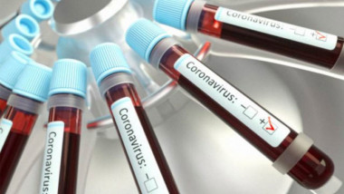Software colombiano diagnostica casos sospechosos de Covid-19