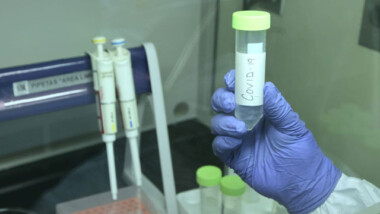 Yucatán tiene más de mil casos activos de covid