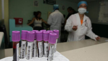 México acumula 73 mil 493 muertes y 697 mil 663 contagios de COVID-19