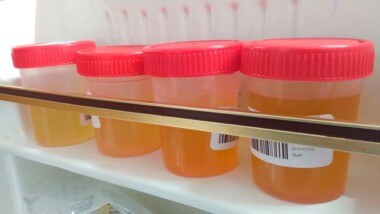 Cómo prevenir las infecciones de las vías urinarias
