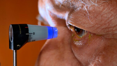 Glaucoma, principal causa de ceguera en personas mayores de 60 años