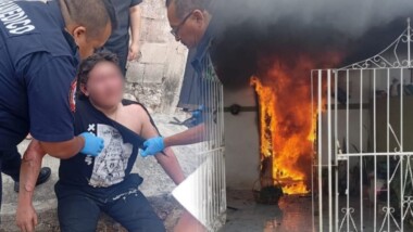 Sufre quemaduras por rescatar a sus mascotas al incendiarse su casa