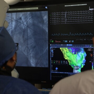 Incorporan sistema de mapeo electroanatómico al tratamiento de arritmias