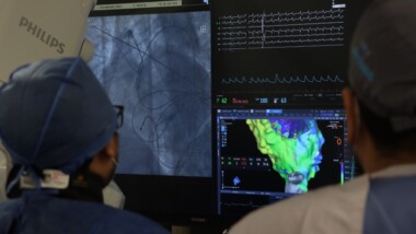 Incorporan sistema de mapeo electroanatómico al tratamiento de arritmias