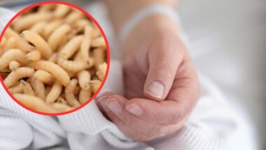 Confirman primera muerte humana por miasis en Yucatán