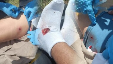 Le disparan cuando circulaba por una carretera de Yucatán